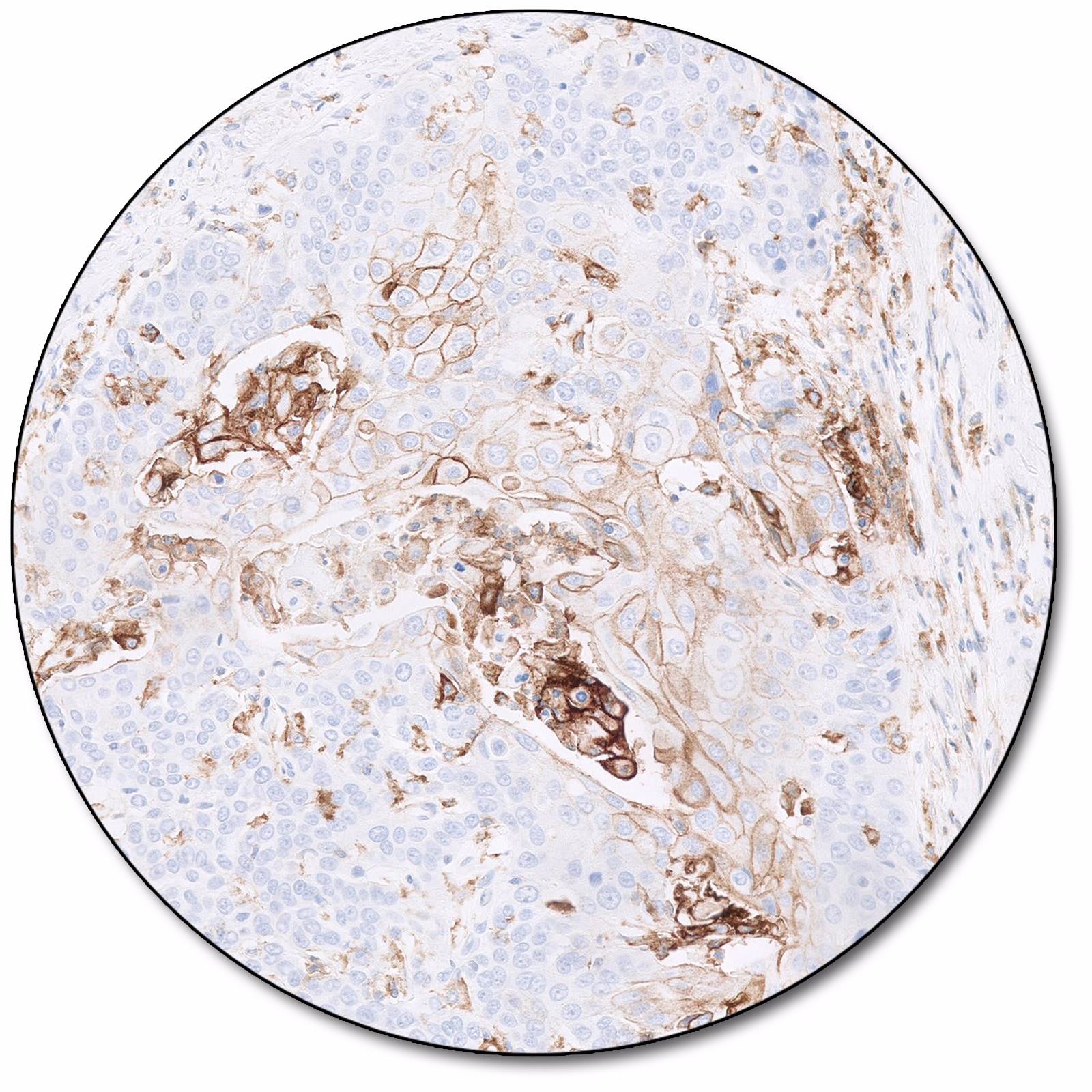 PD-L1 IHC 22C3 pharmDx for Autostainer Link 48